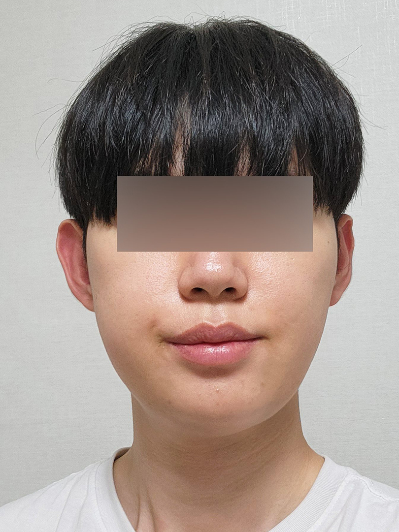 맥스구강악안면외과 리얼후기