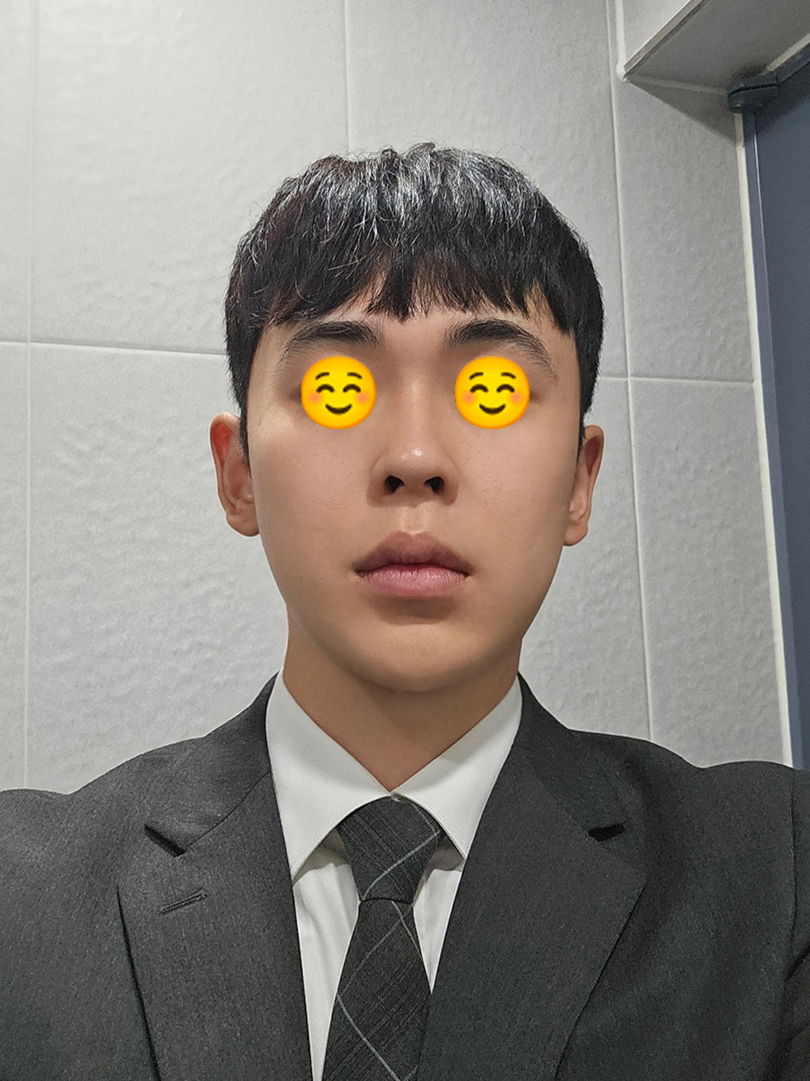 맥스구강악안면외과 리얼후기
