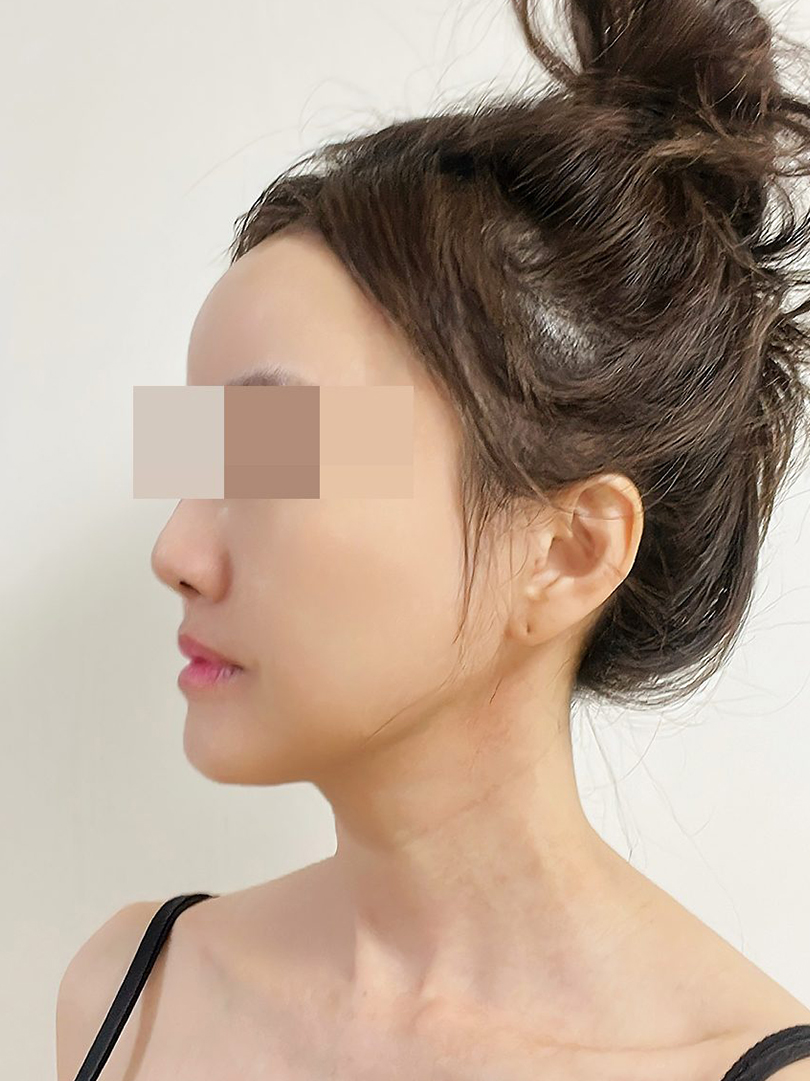 맥스구강악안면외과 리얼후기