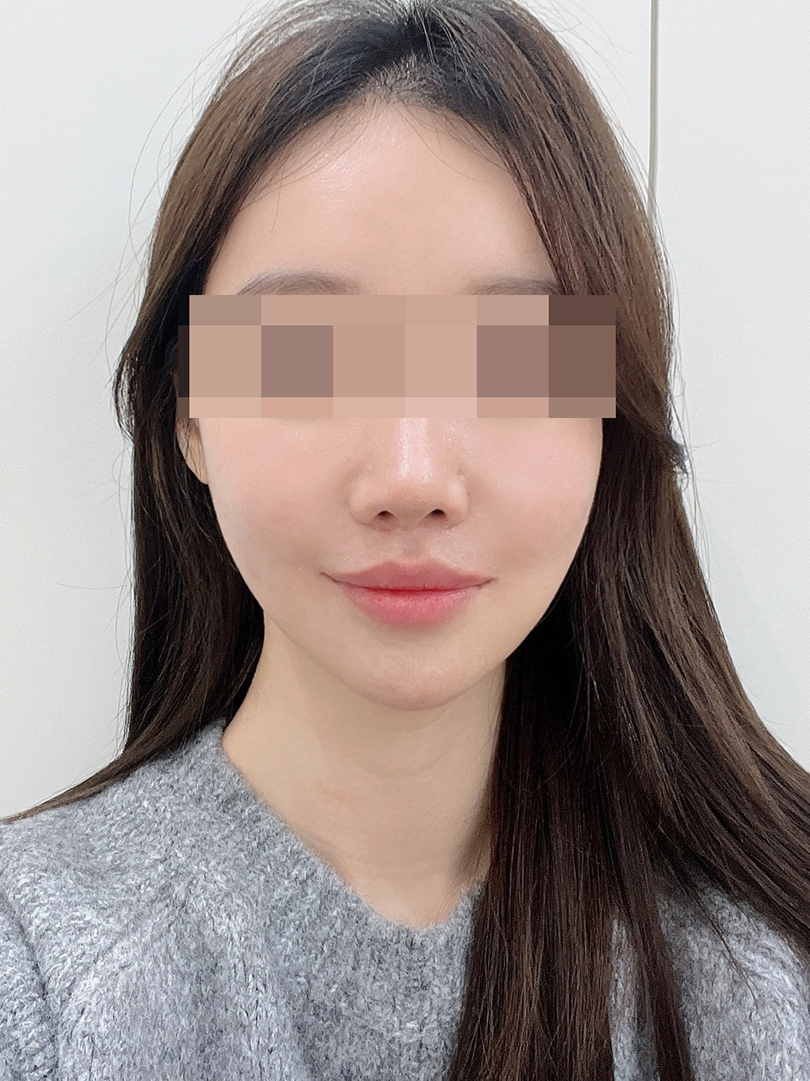 맥스구강악안면외과 리얼후기