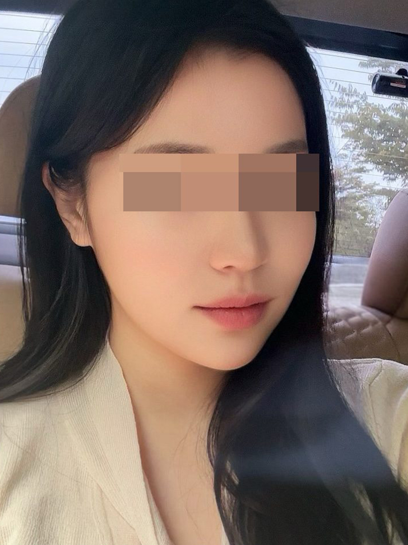 맥스구강악안면외과 리얼후기