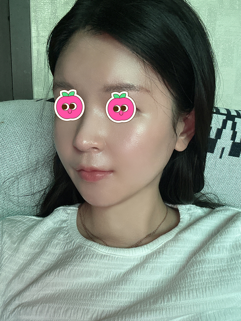맥스구강악안면외과 리얼후기