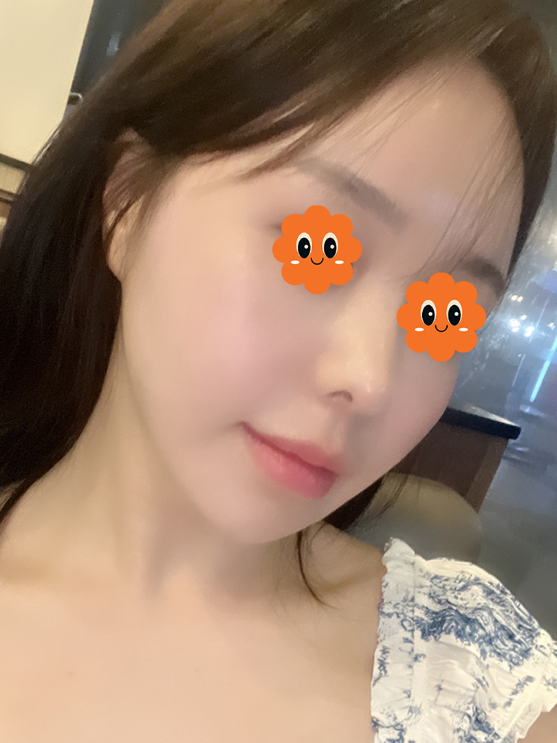 맥스구강악안면외과 리얼후기
