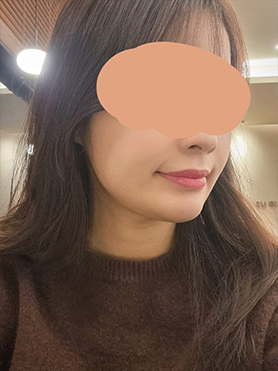 맥스구강악안면외과 리얼후기
