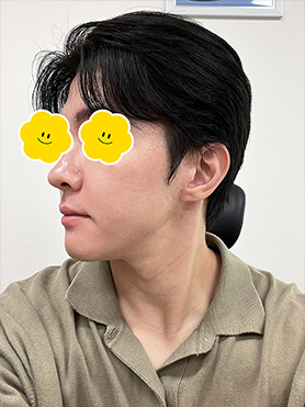 맥스구강악안면외과 리얼후기