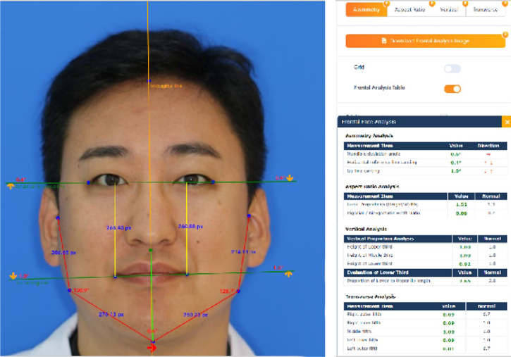 A.I 안면분석