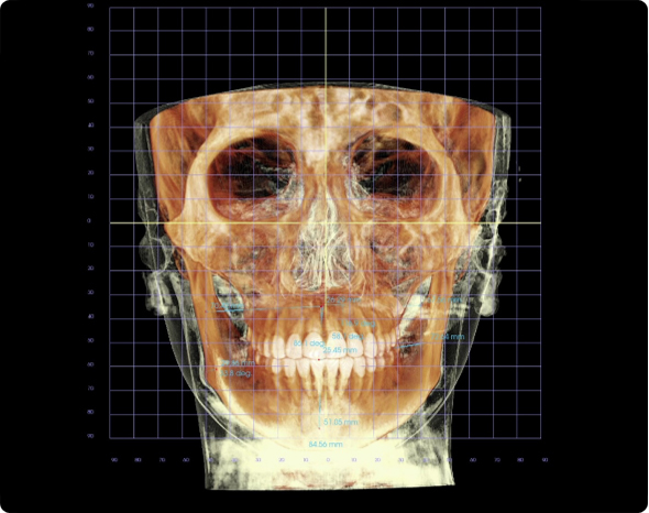 3D AI 안면분석