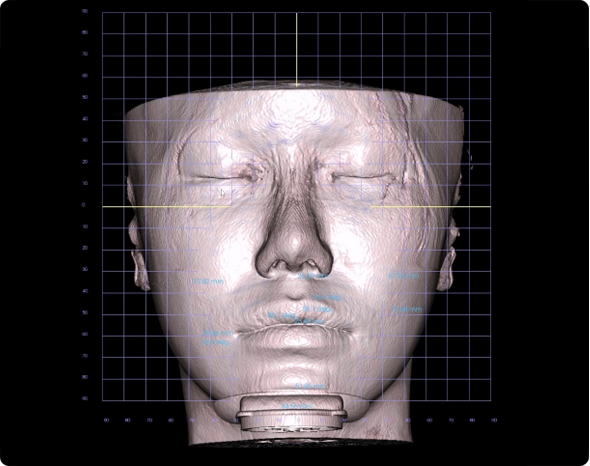3D AI 안면분석