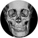 맥스 3D AI 미용양악수술