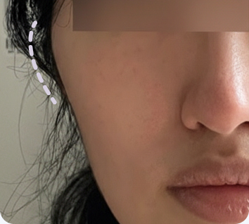 MACS solves various face shape concerns