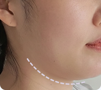 MACS solves various face shape concerns