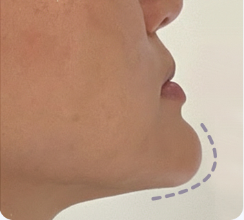 MACS solves various face shape concerns