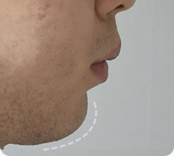MACS solves various face shape concerns
