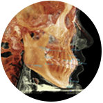 맥스 3D AI 미용양악수술