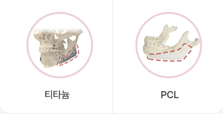 맥스 시그니처 부위별 맞춤형 보형물 재건술
