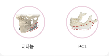 맥스 시그니처 부위별 맞춤형 보형물 재건술