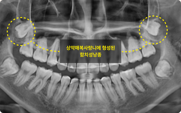 맥스구강악안면외과 치과의원